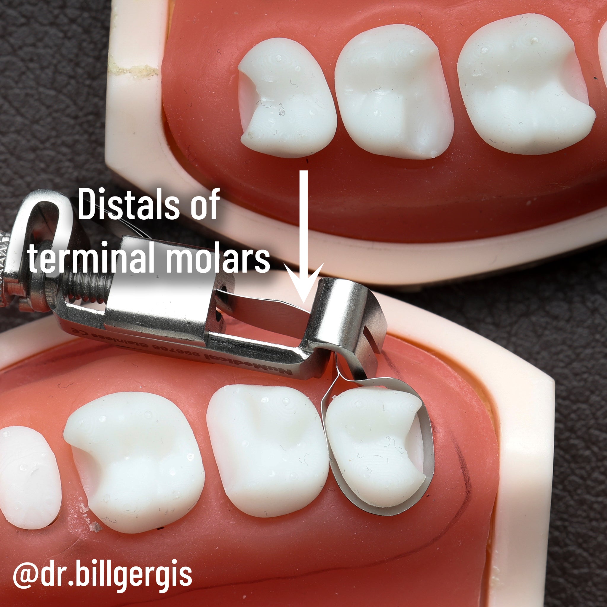 Matrice DME Gergis taille n° 2