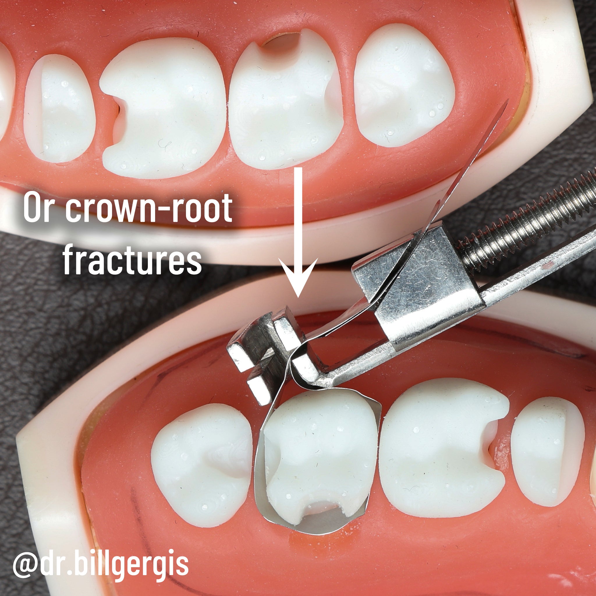 Matrice DME Gergis taille n° 2