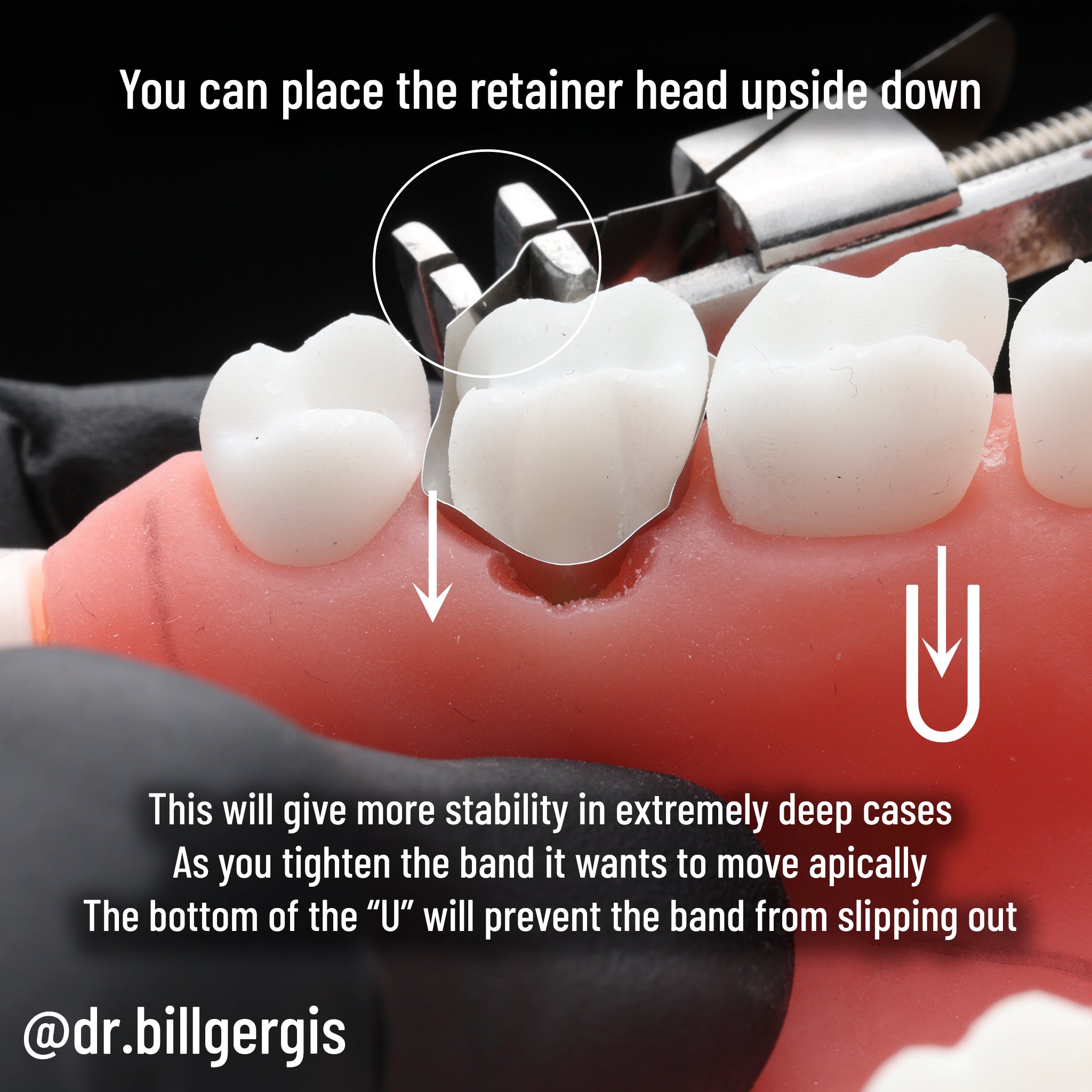 Matrice DME Gergis taille n° 2