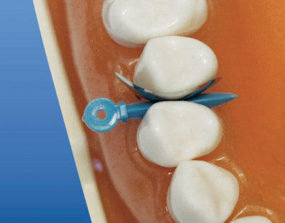 Cales de fixation auto-adaptatives, lot de 40