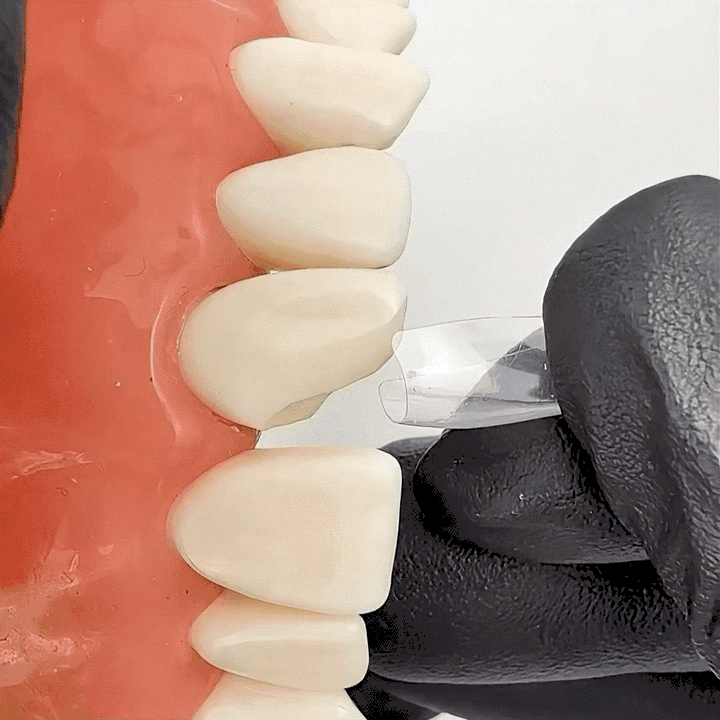 Bow Anterior Matrices 10pcs