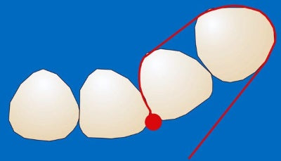 Bandes d'arrêt transparentes de 10 mm de large, lot de 12