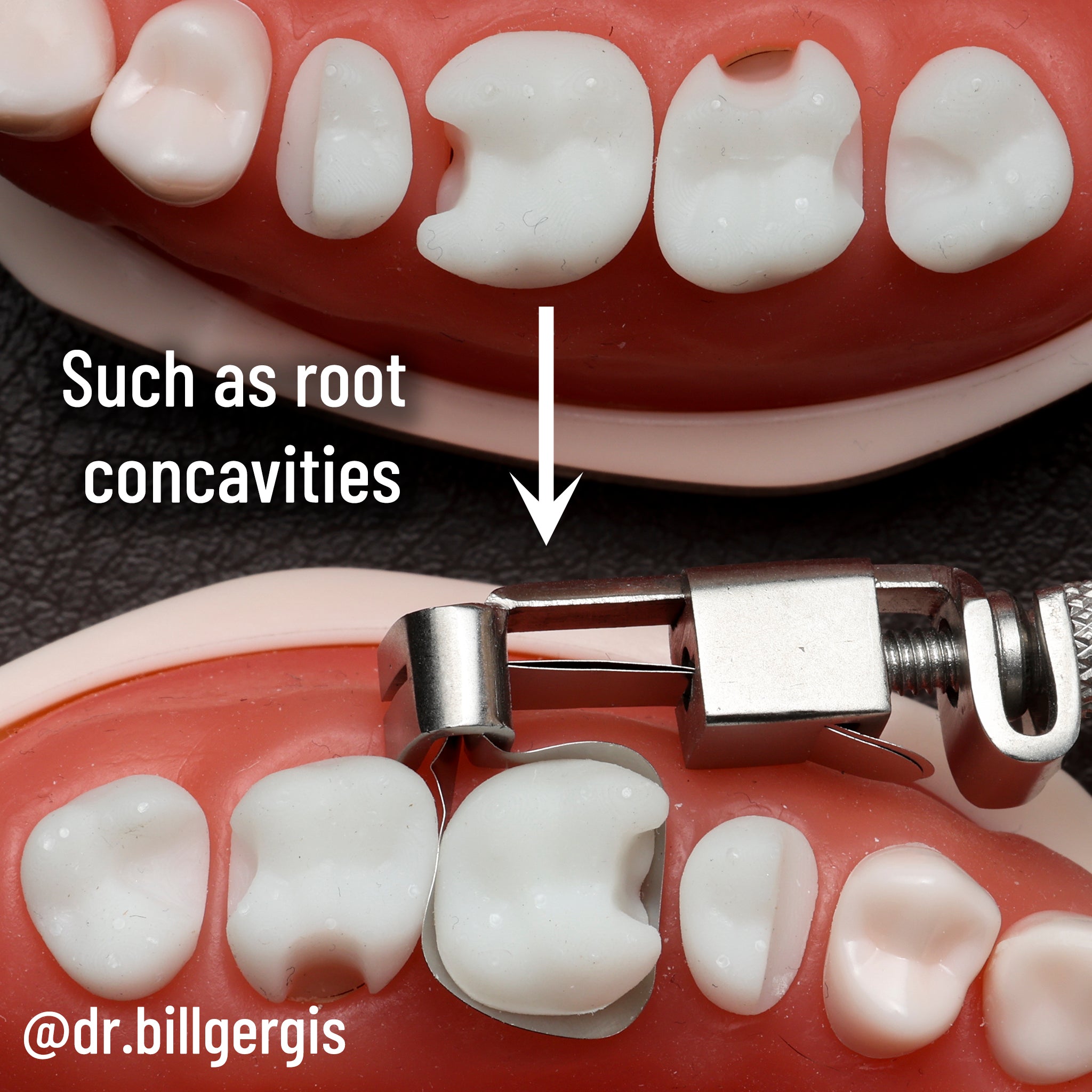 Matrice DME Gergis taille n° 2