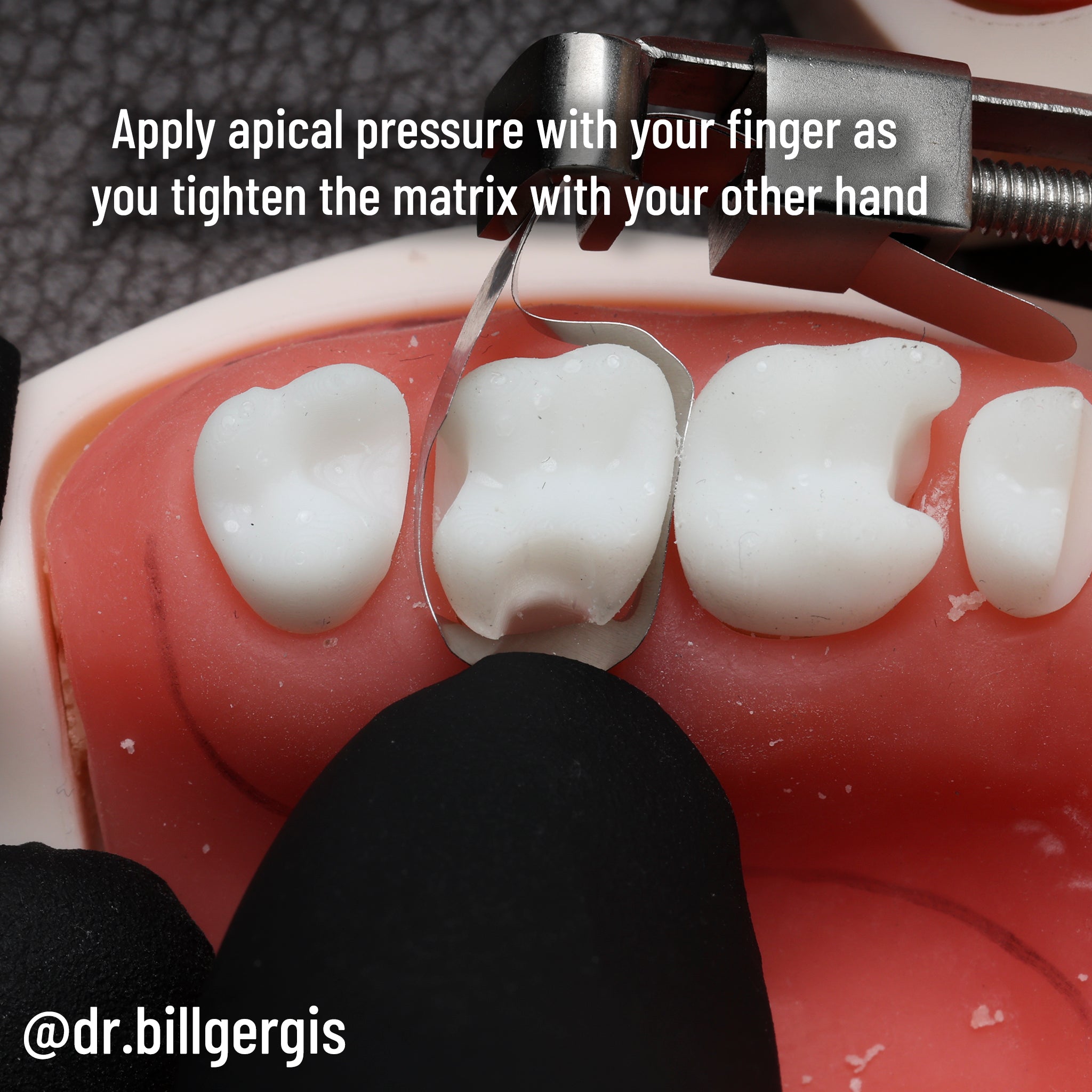 Matrice DME Gergis taille n° 2