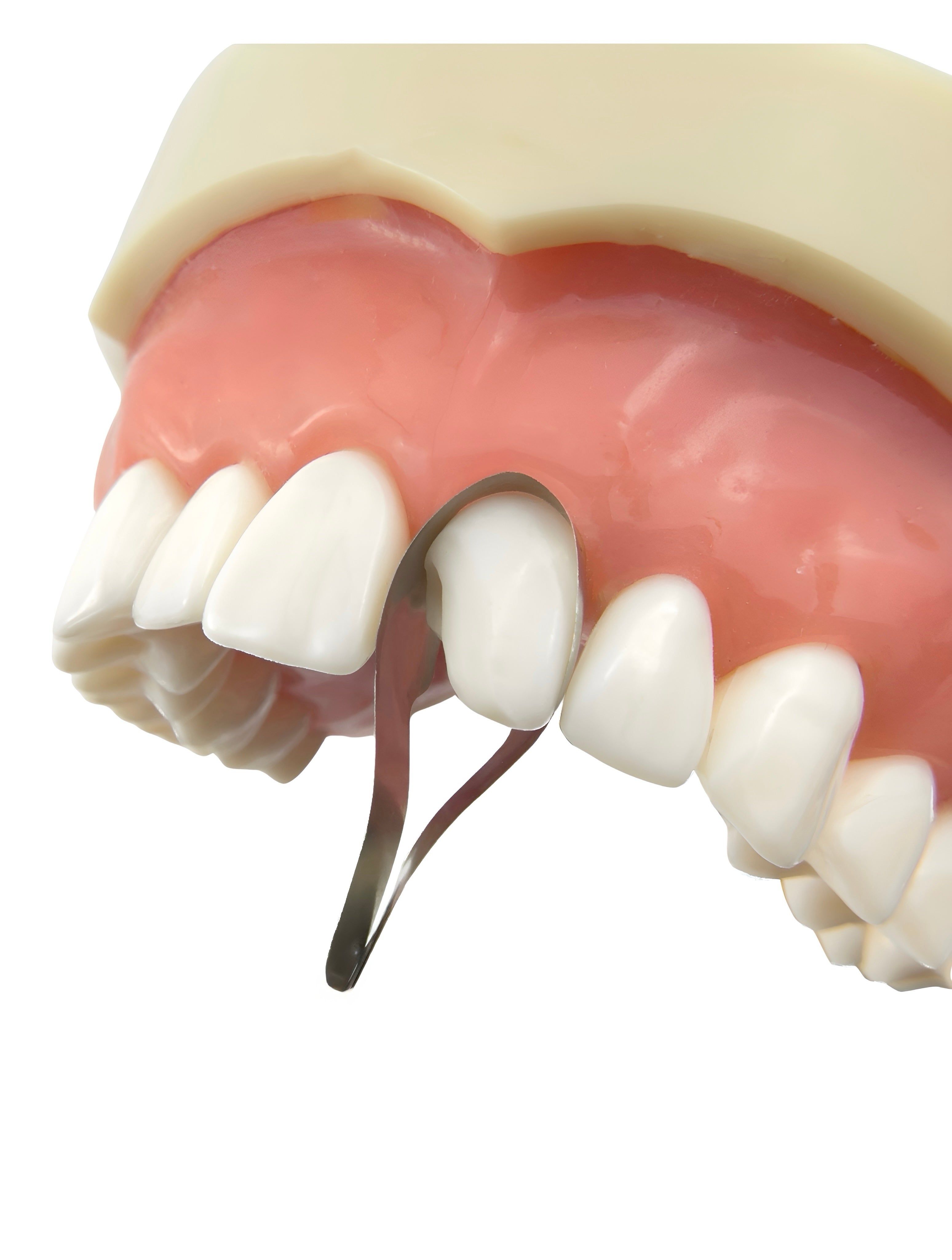 Twin Anterior Matrices (Incisal) 12pcs