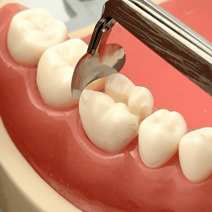 Matrices profilées sectionnelles moyennes, 50 pièces