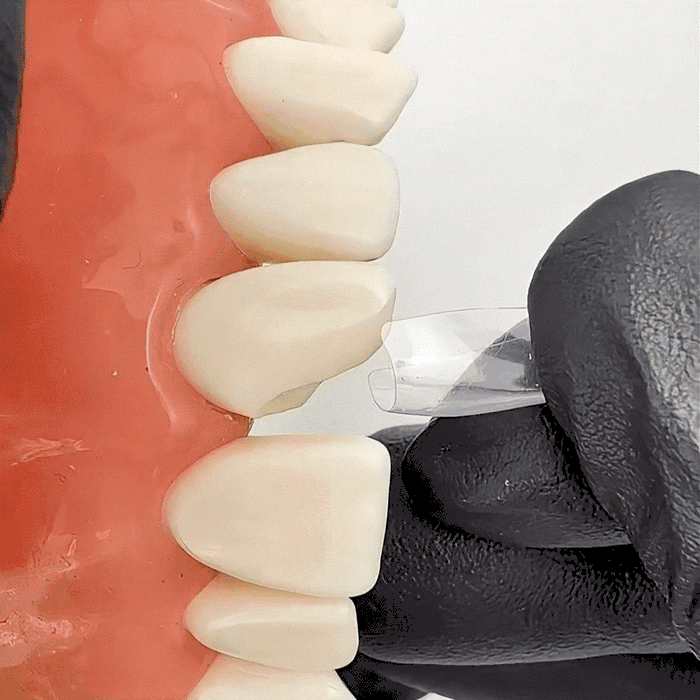 Bow Anterior Matrices 10pcs