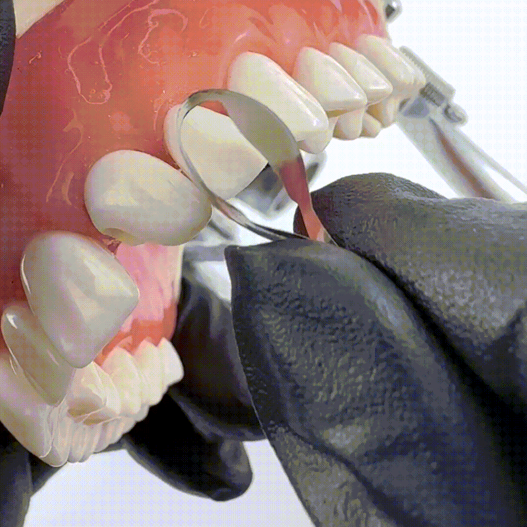 Matrices anteriores gemelas (incisales) 12 piezas