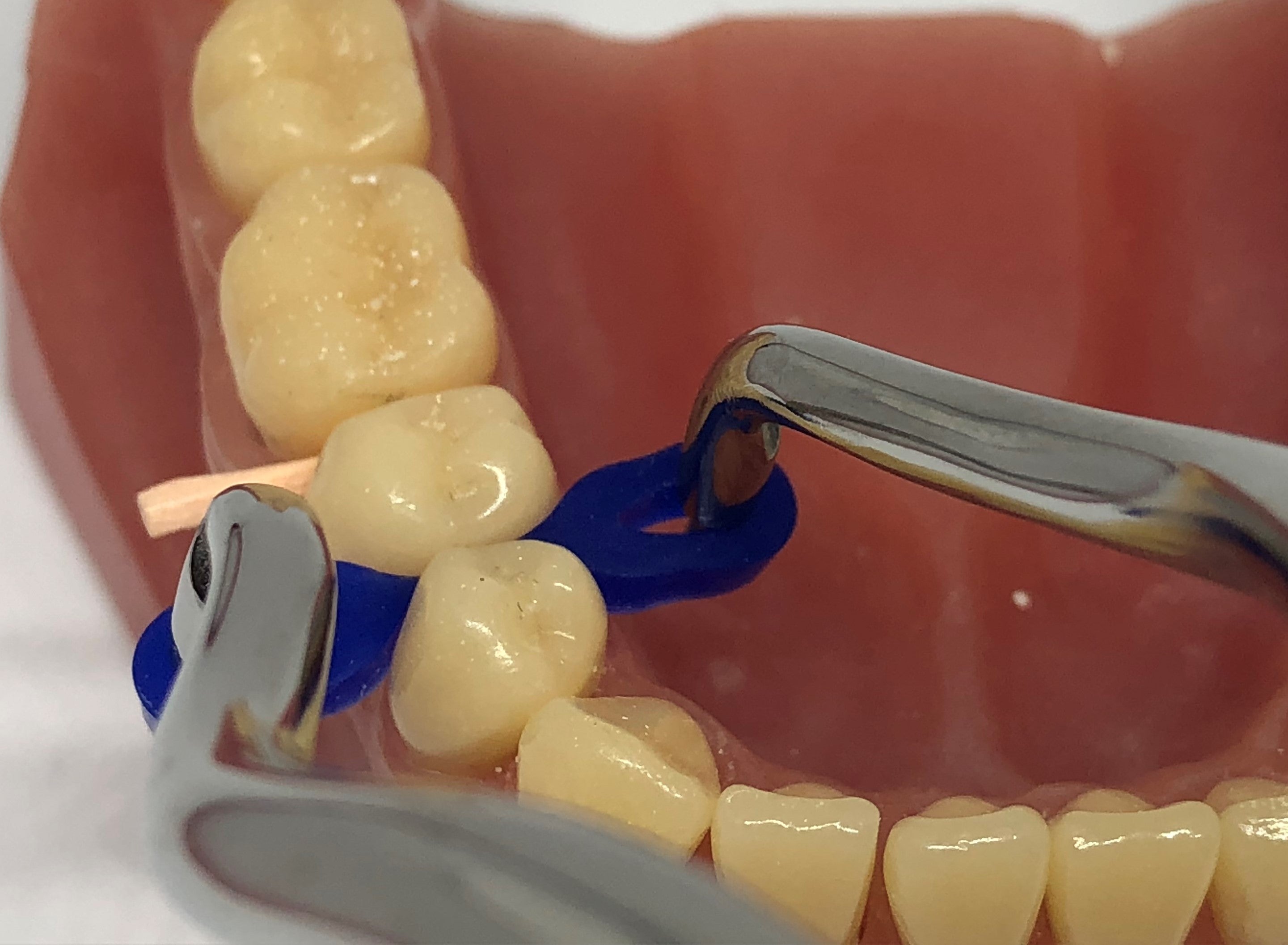 Cales de fixation « élastiques » 40 pièces