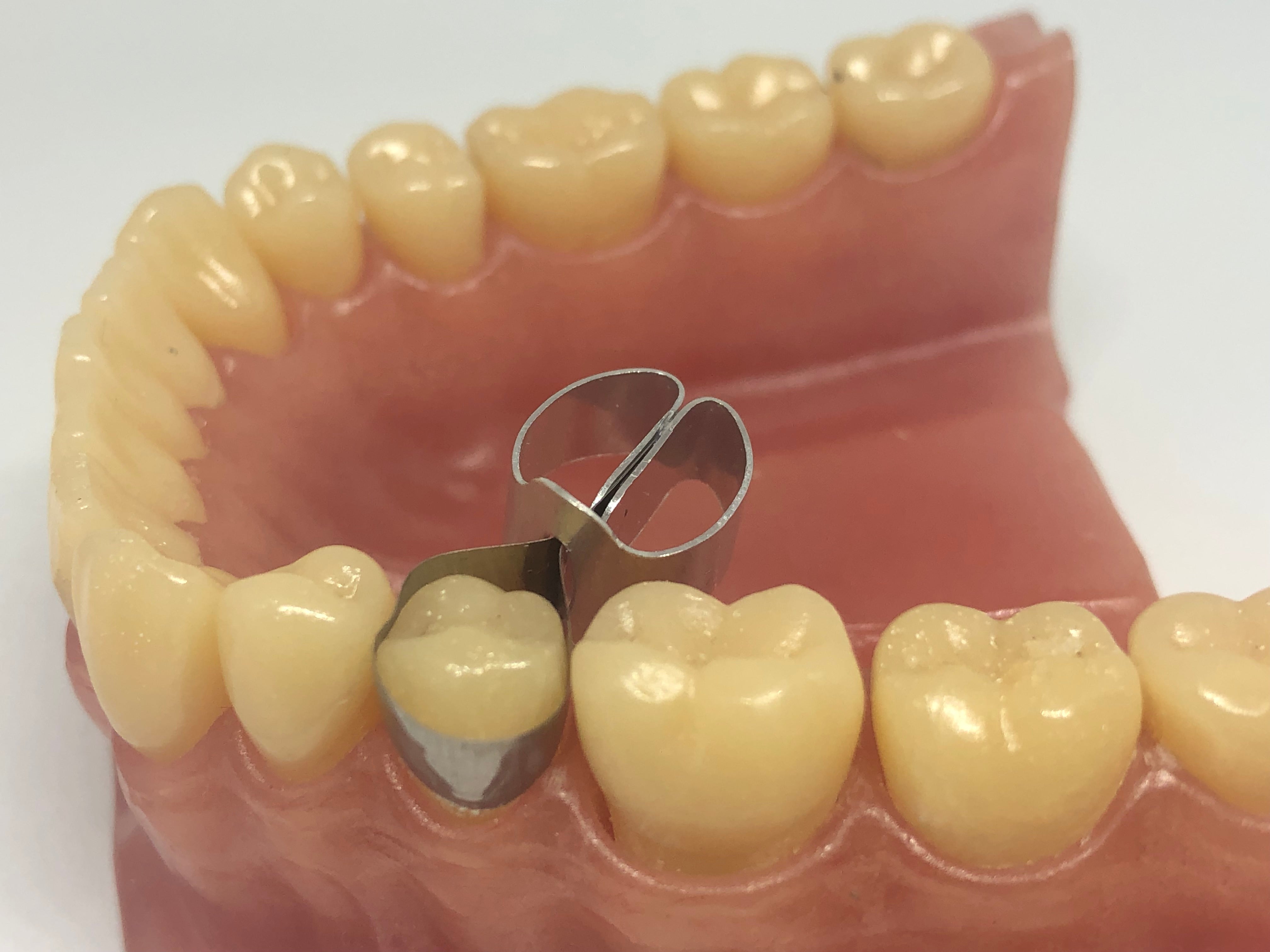 Matrices metálicas contorneadas para molares combinadas con abrazadera 10 piezas