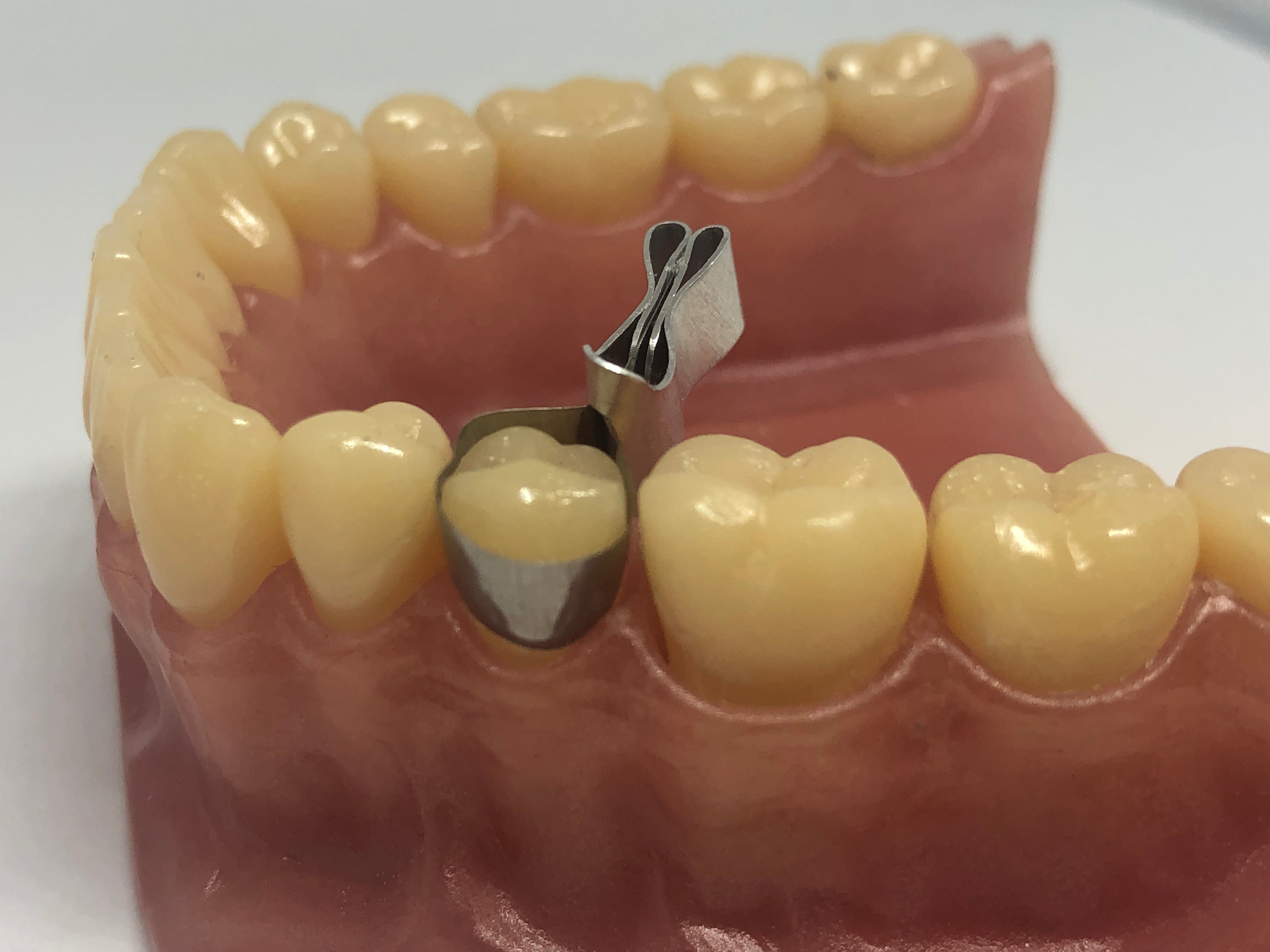 Matrices metálicas contorneadas para molares combinadas con abrazadera 10 piezas