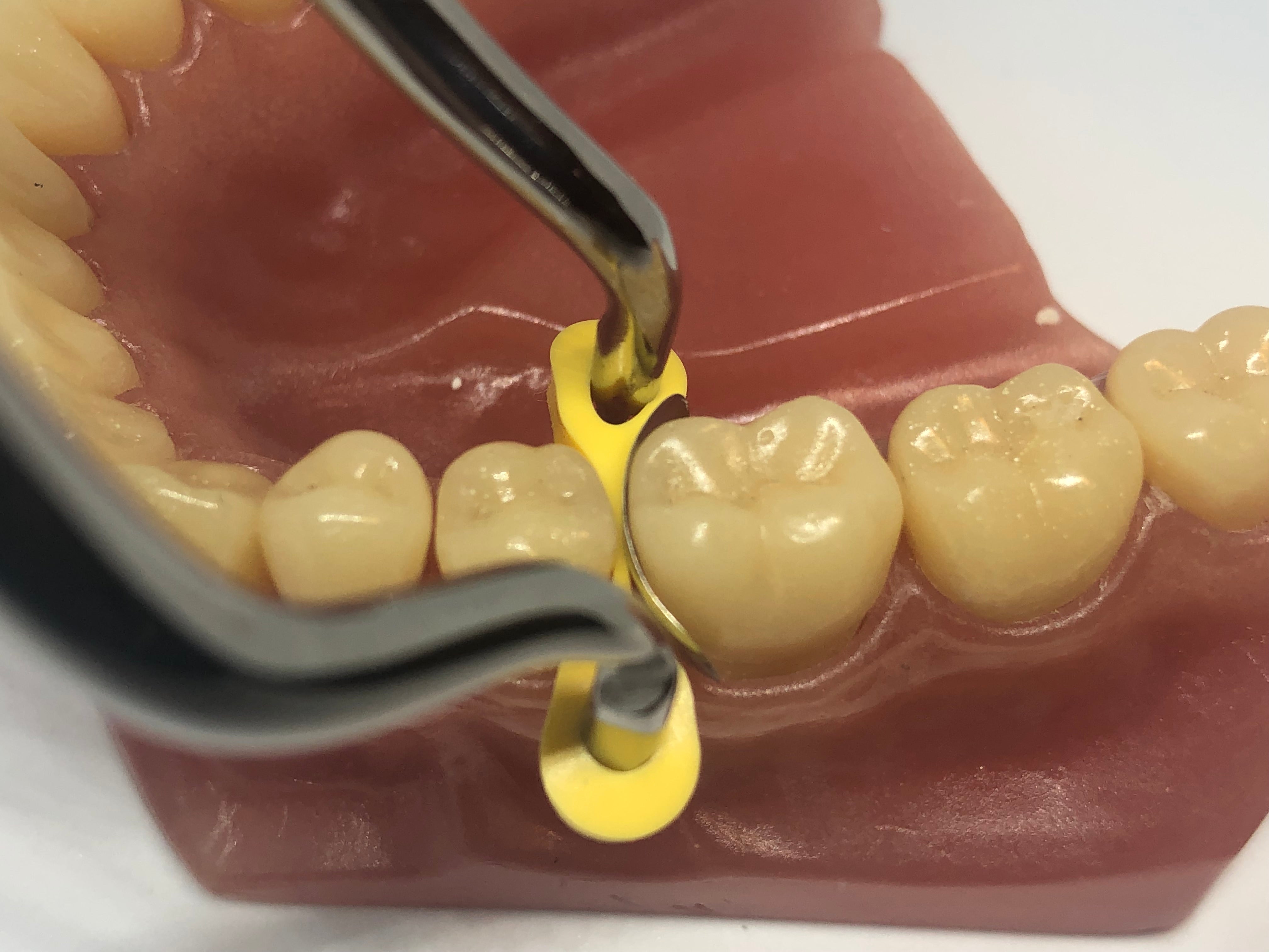 Cales de fixation « élastiques » 40 pièces