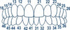 Anterior Transparent Crowns 64pcs